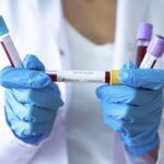coronavirus, virus detection test
