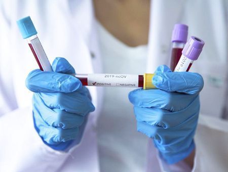 coronavirus, virus detection test