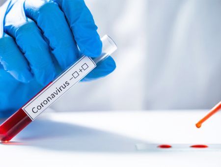 coronavirus, virus test