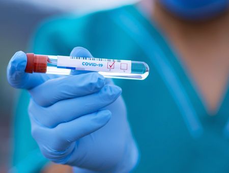 coronavirus, COVID-19 test