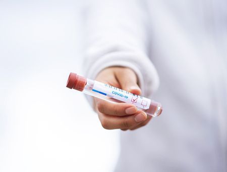 coronavirus, test positive in COVID-19