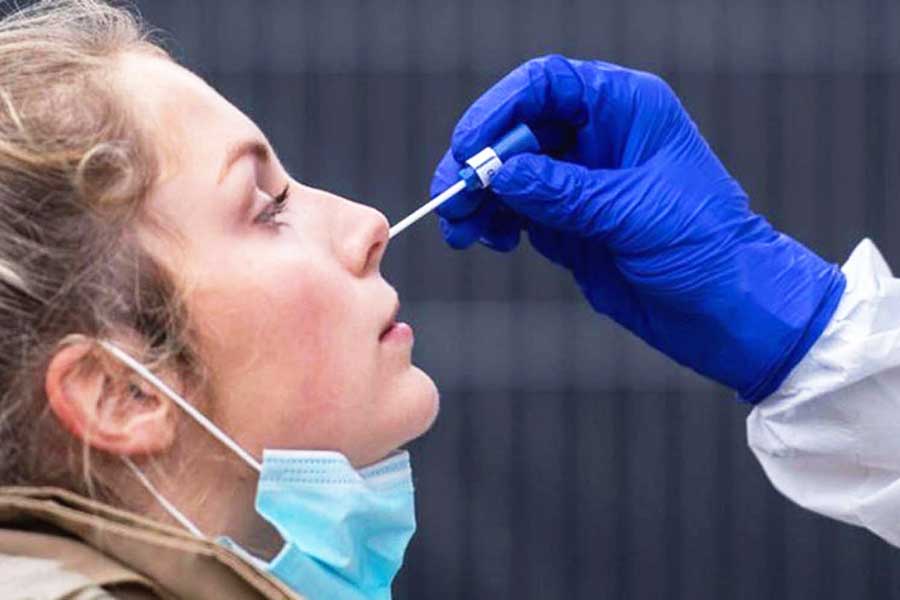 pandemia de coronavirus, test PCR