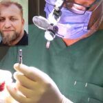 Turkey, patient dead during hair transplant