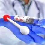 coronavirus, test PCR