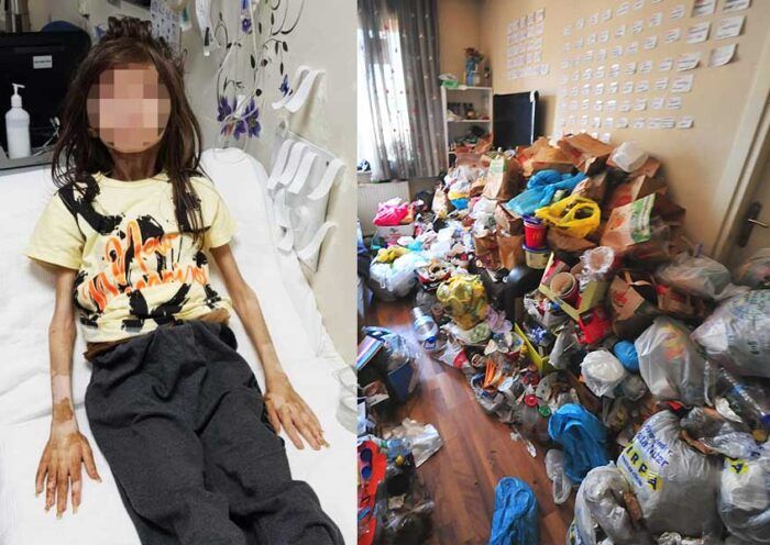 Turkey in shock for child captive among garbage
