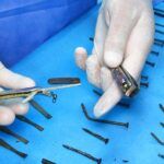 Turkish doctors find objects in woman's stomach